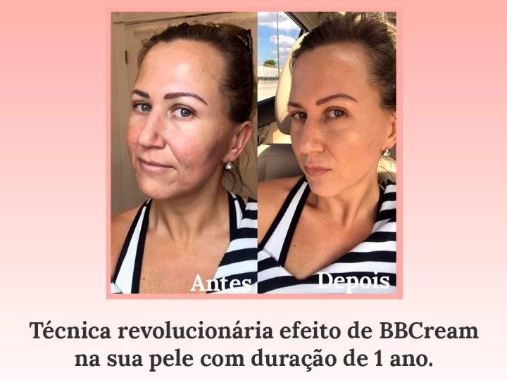 Pele de Porcelana: a técnica que promove a iluminação da pele, fazendo o efeito de make-up, promete conquistar o Brasil